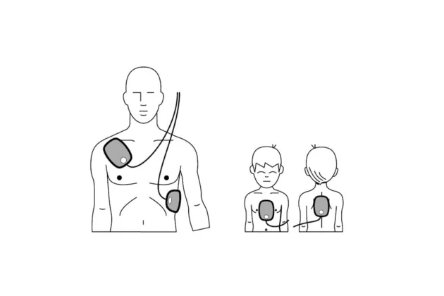 defibrillator-aed-electrode-position